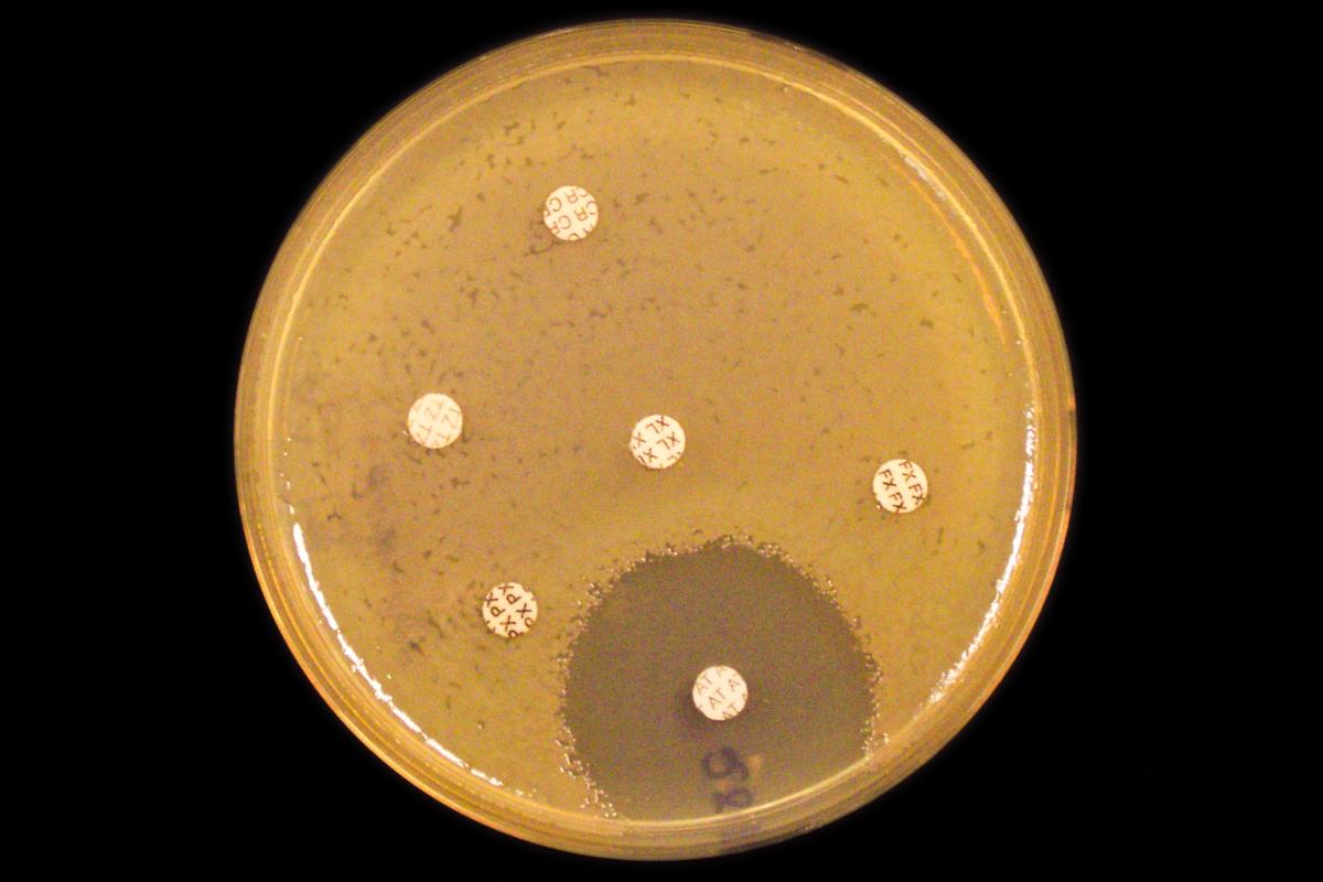 AMR BRIDGE_antibiotikaresistens_foto Nasjonalt senter for påvisning av antibiotikaresistens K-res.jpg